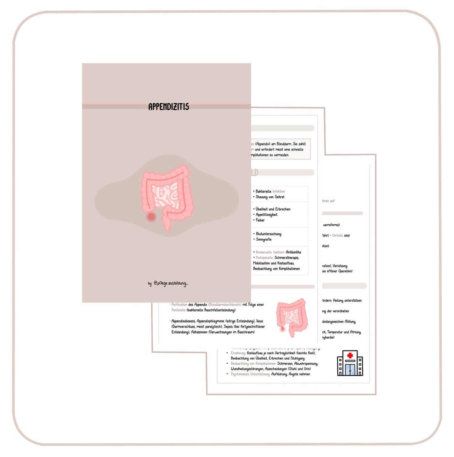 Appendizitis