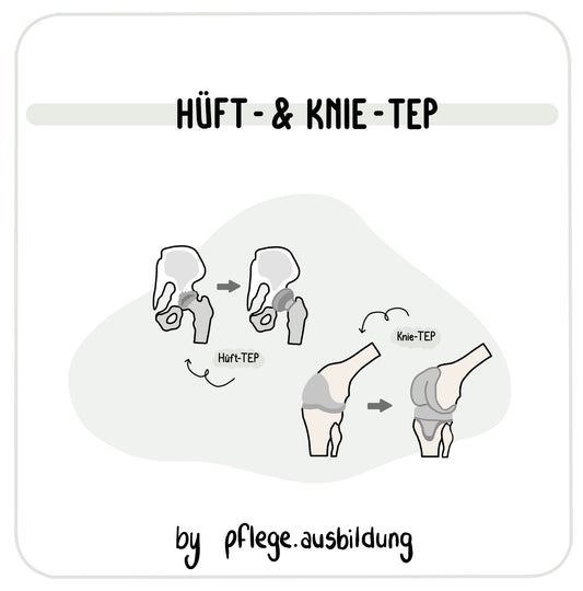 Hüft- & Knie-TEP