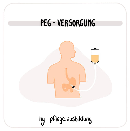 PEG-Versorgung