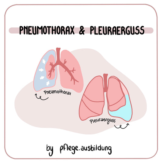 Pneumothorax & Pleuraerguss