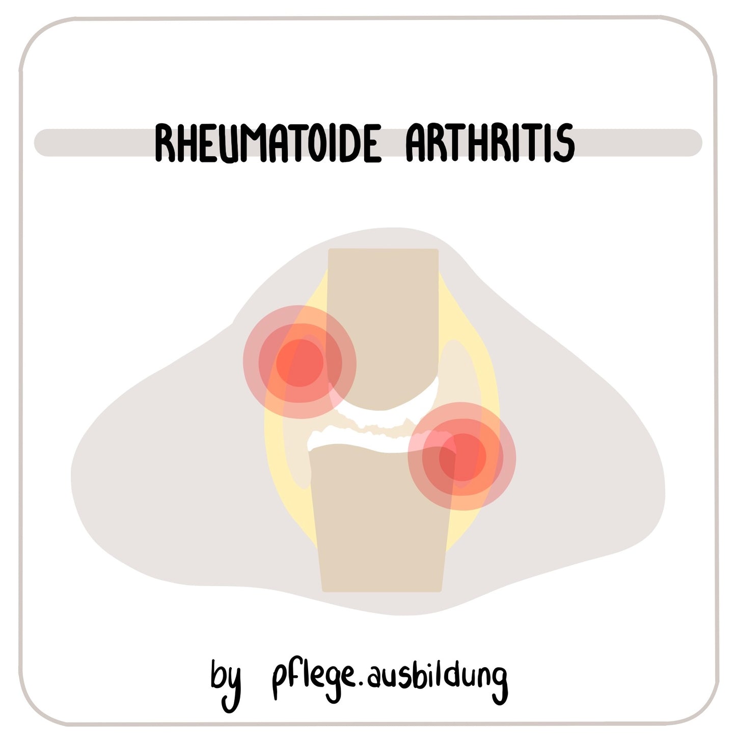 Rheumatoide Arthritis