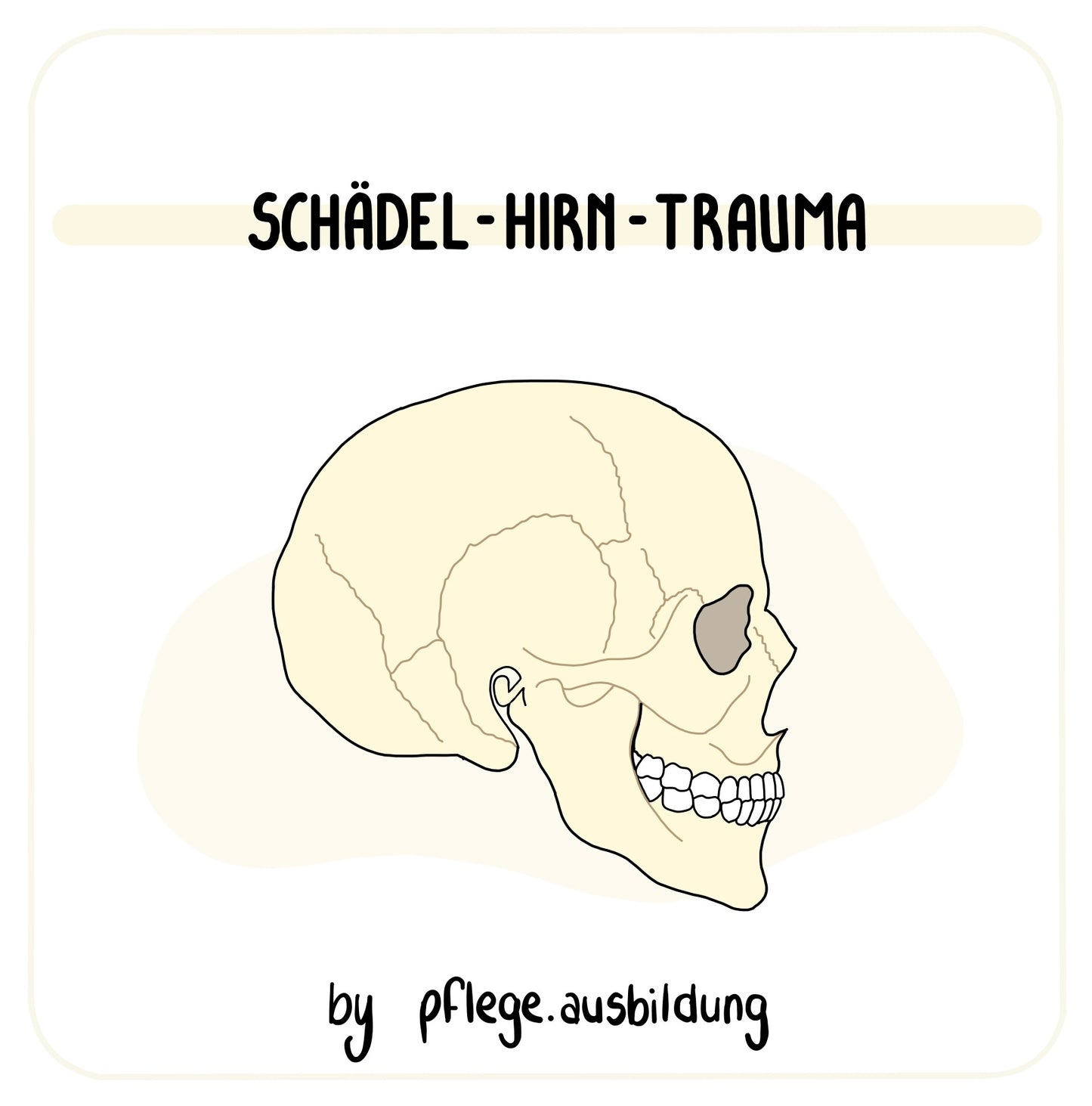 Schädel-Hirn-Trauma
