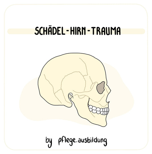 Schädel-Hirn-Trauma
