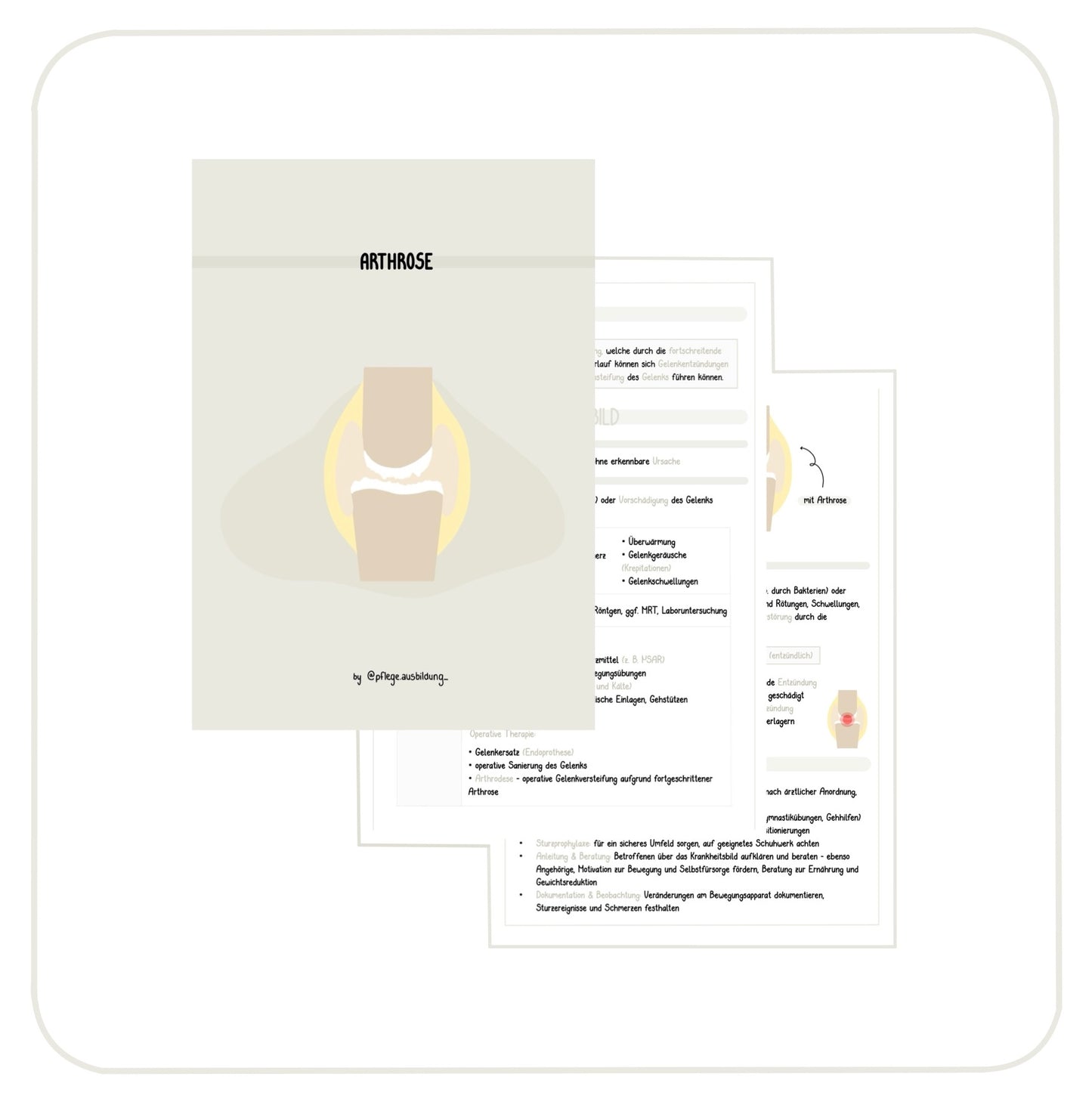 Arthrose