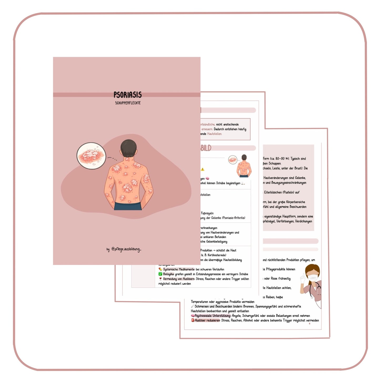 Psoriasis