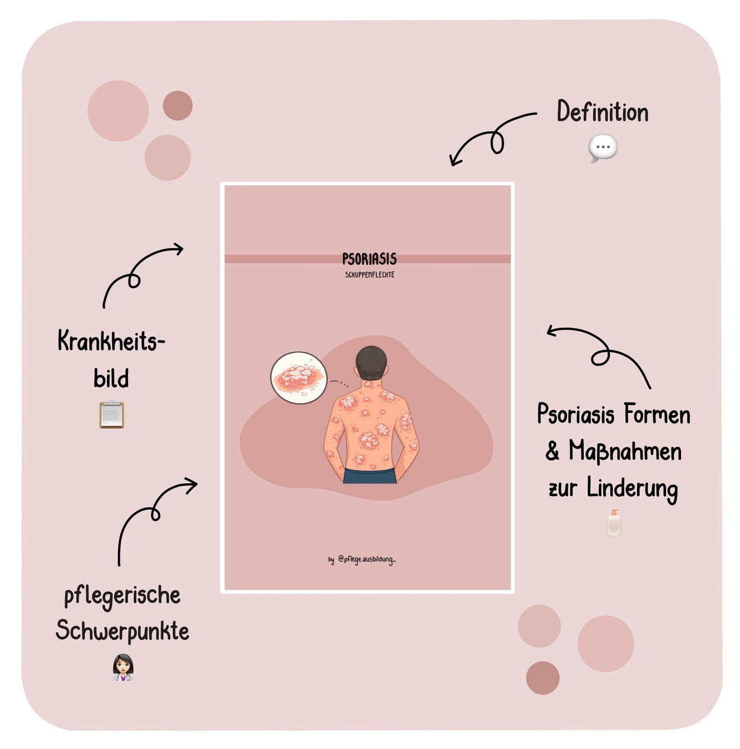 Psoriasis