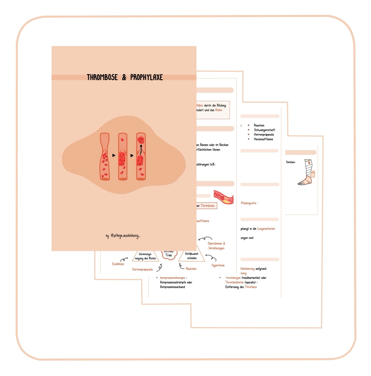 Thrombose