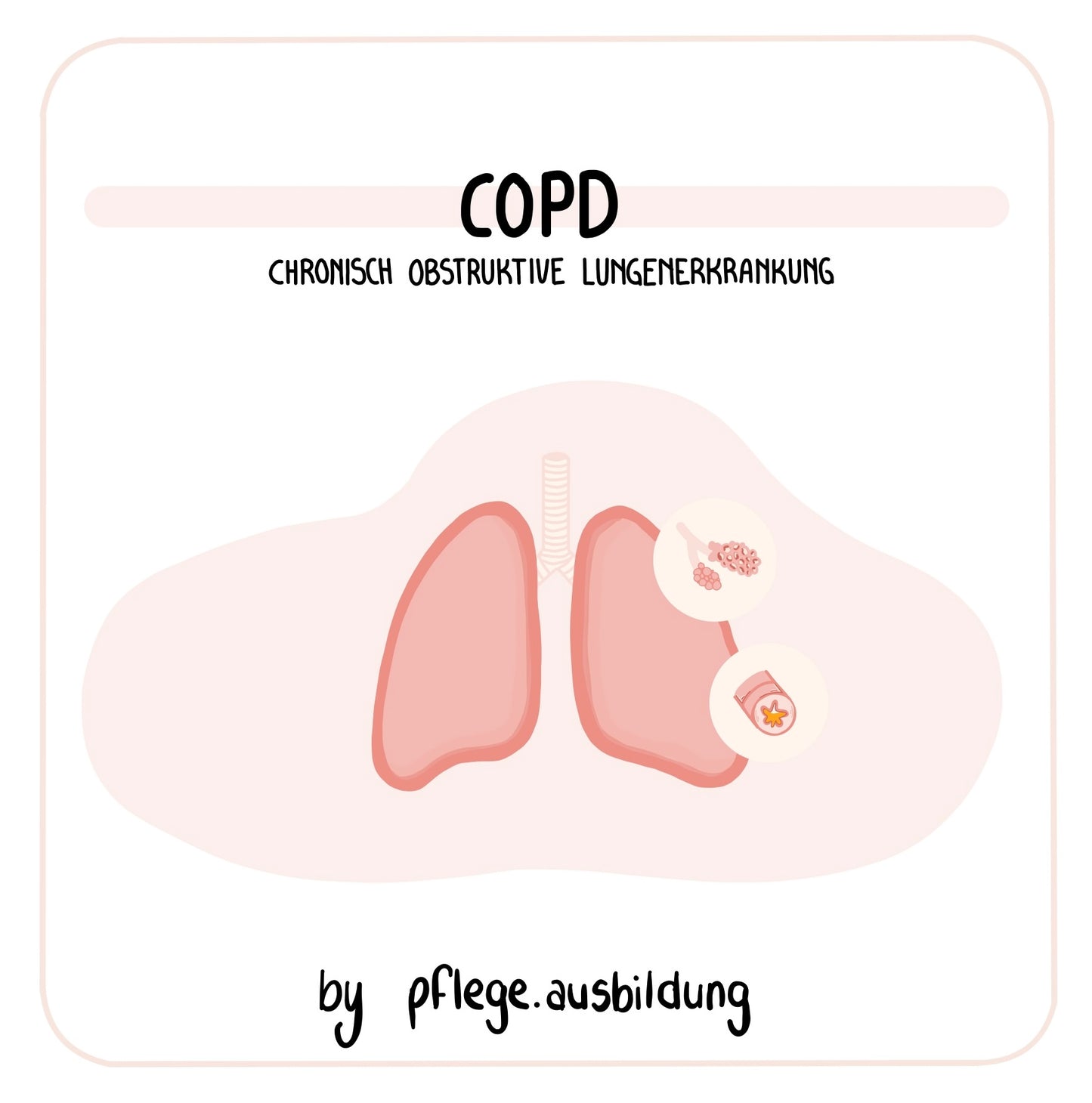 COPD