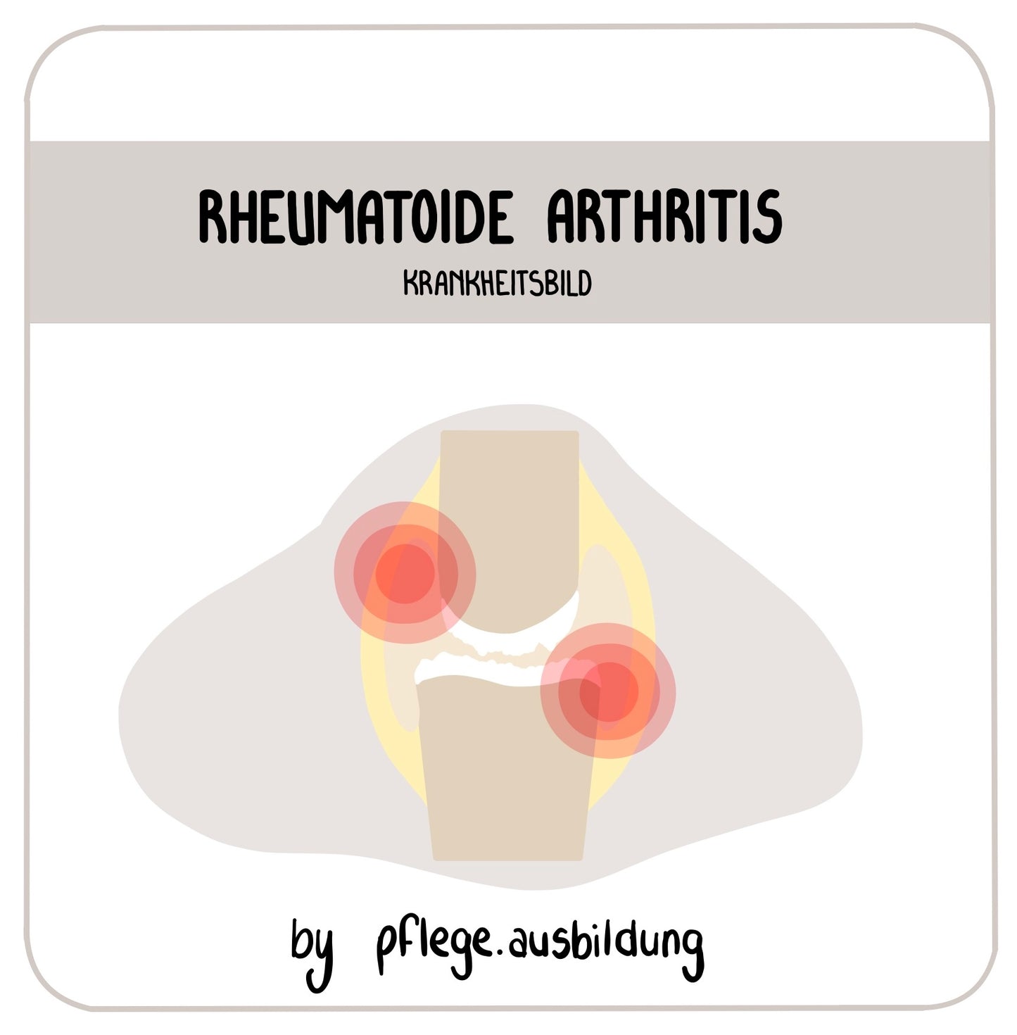 Rheumatoide Arthritis