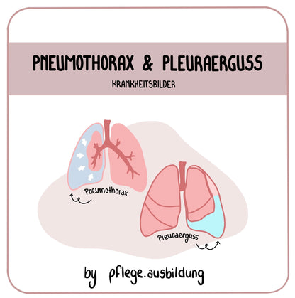 Pneumothorax & Pleuraerguss