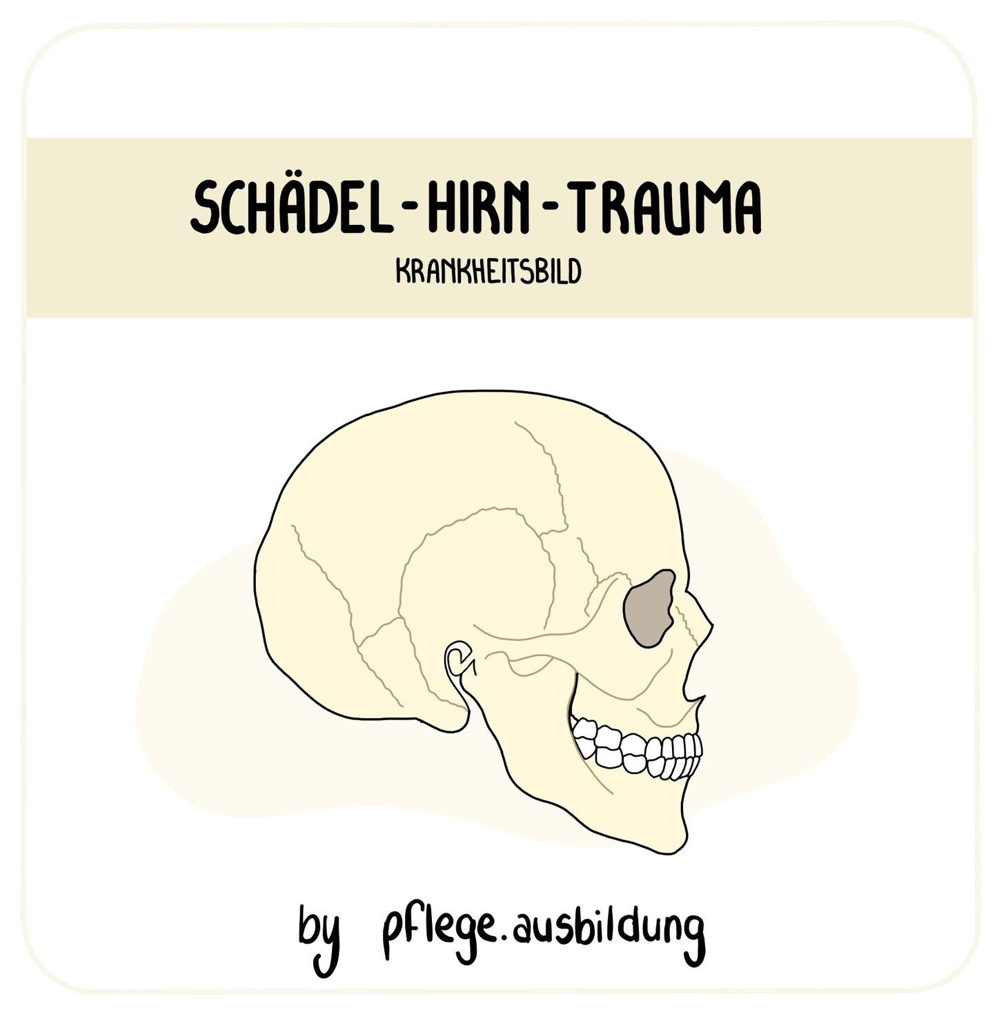 Schädel-Hirn-Trauma