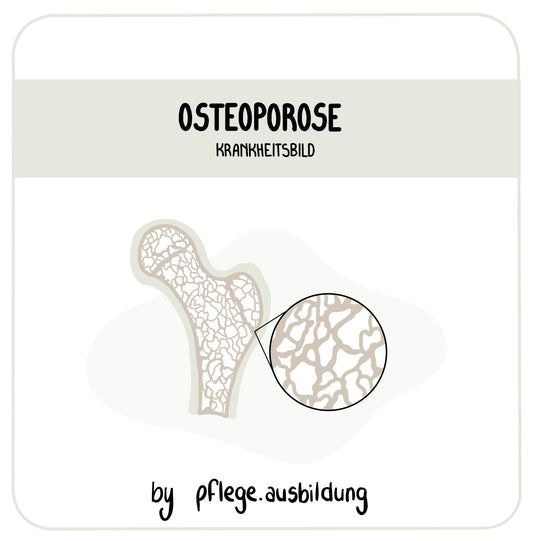 Osteoporose