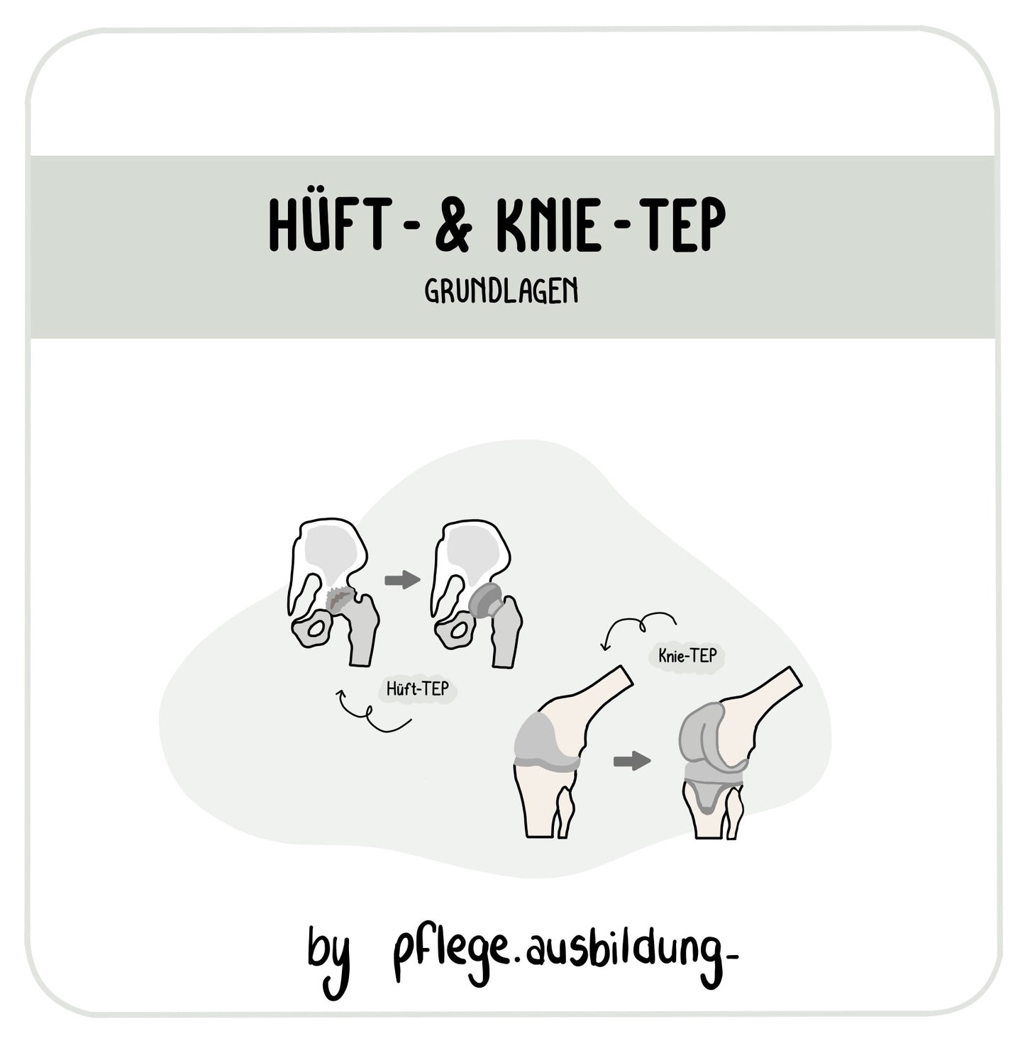 Hüft- & Knie-TEP