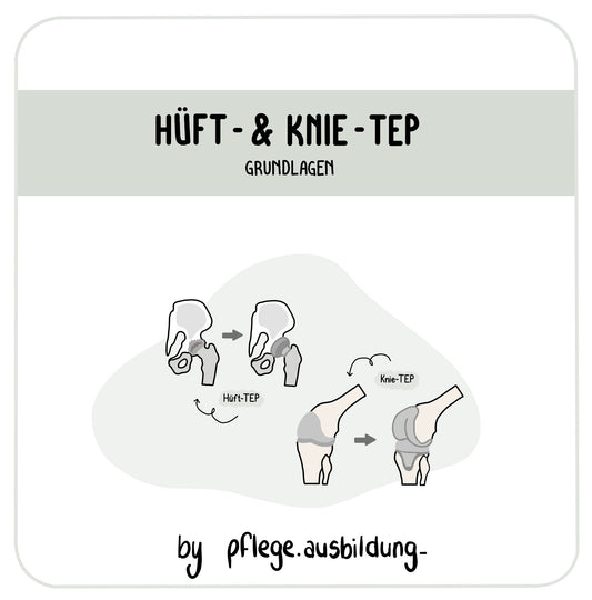 Hüft- & Knie-TEP