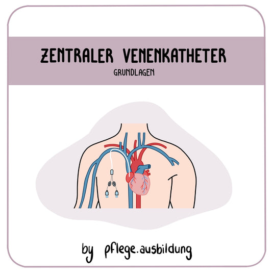 Zentraler Venenkatheter (ZVK)