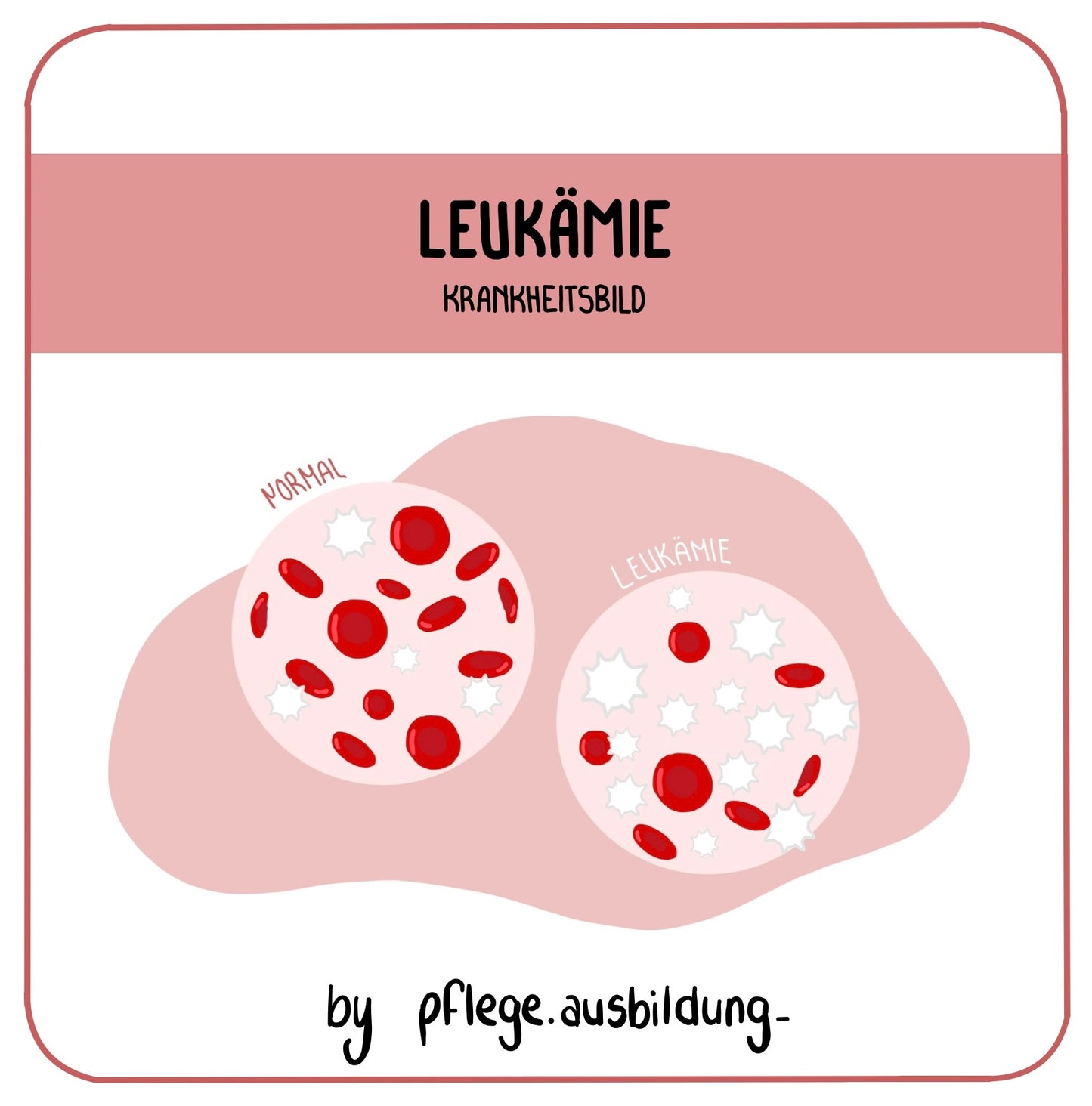 Leukämie