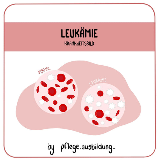 Leukämie