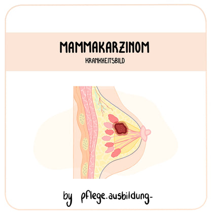 Mammakarzinom