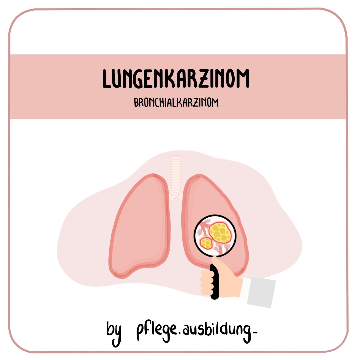 Lungenkarzinom