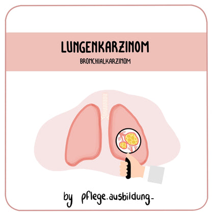 Lungenkarzinom