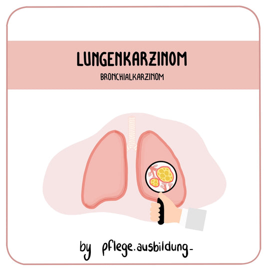 Lungenkarzinom