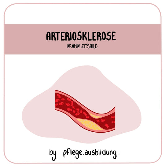 Arteriosklerose