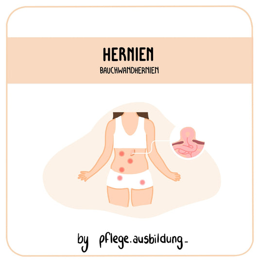 Hernien