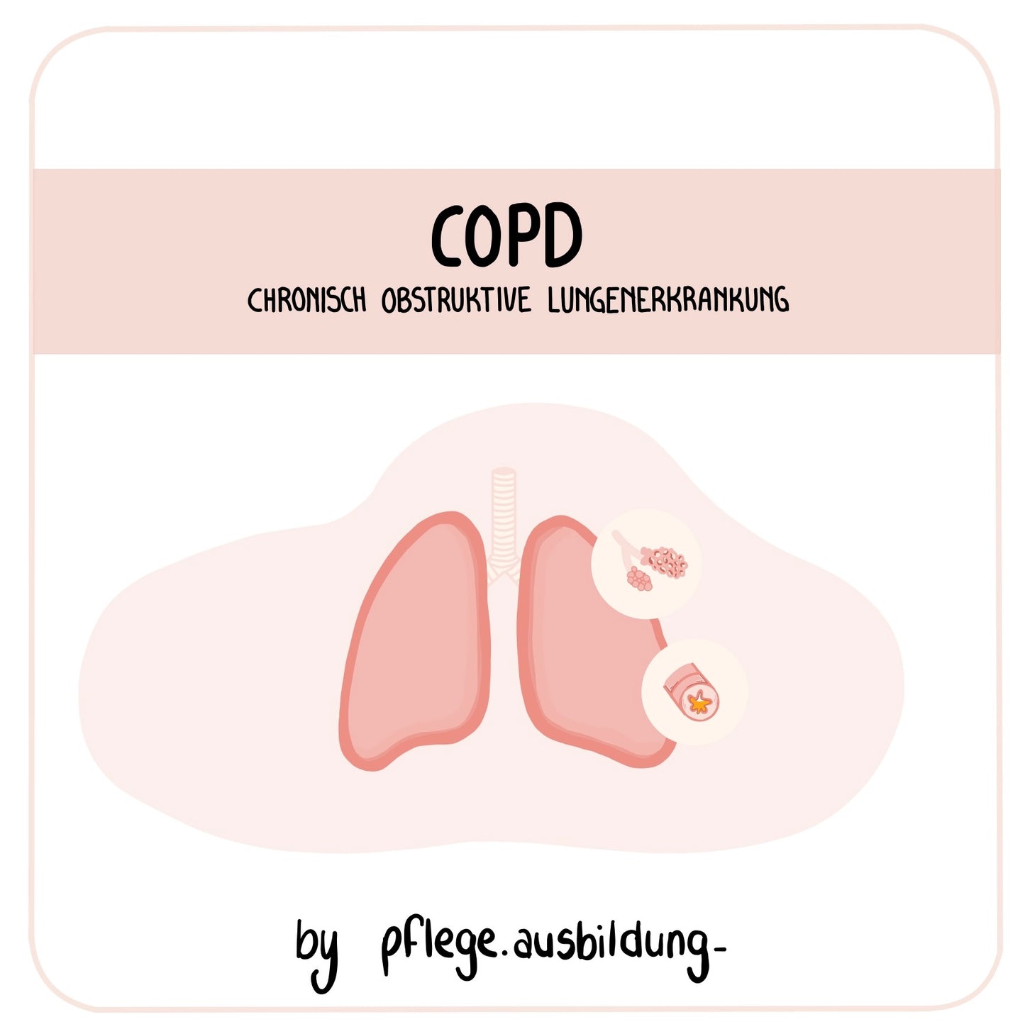 COPD