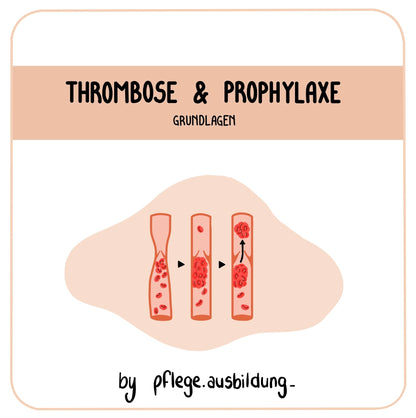 Thrombose & Prophylaxe