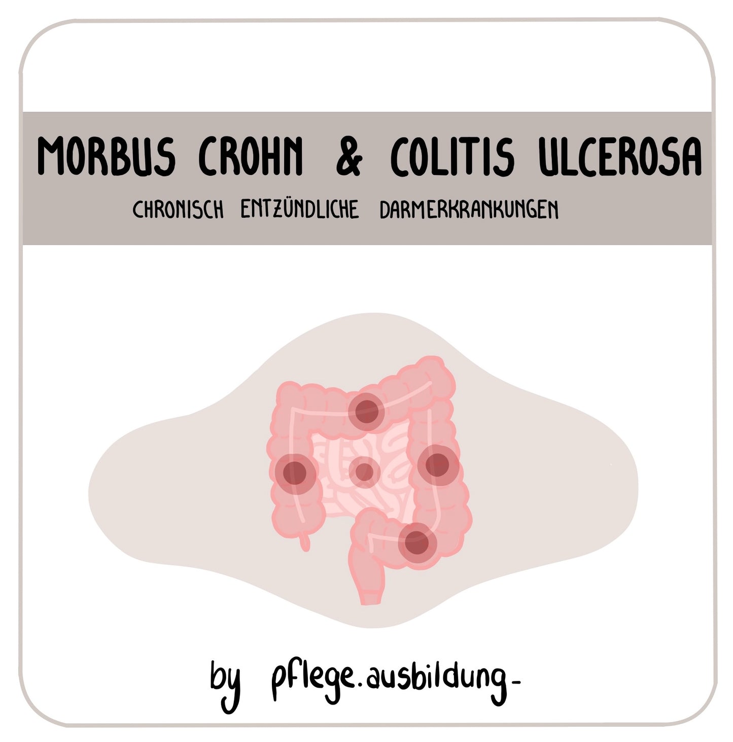 Morbus Crohn & Colitis ulcerosa