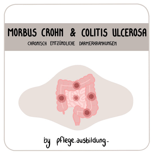 Morbus Crohn & Colitis ulcerosa