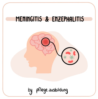 Meningitis & Enzephalitis
