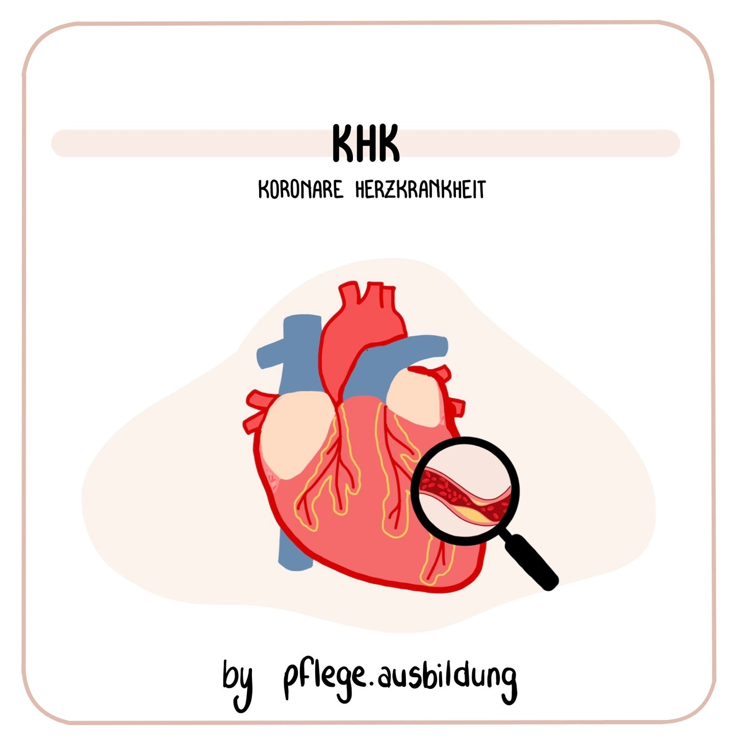 Koronare Herzkrankheit