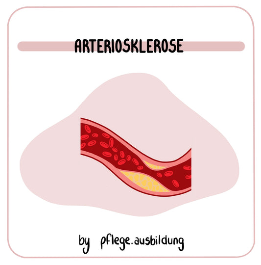 Arteriosklerose