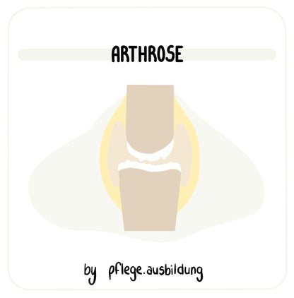 Arthrose