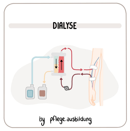 Dialyse