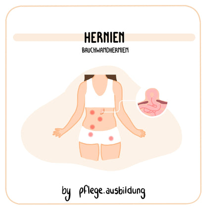 Hernien
