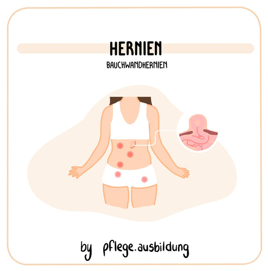 Hernien