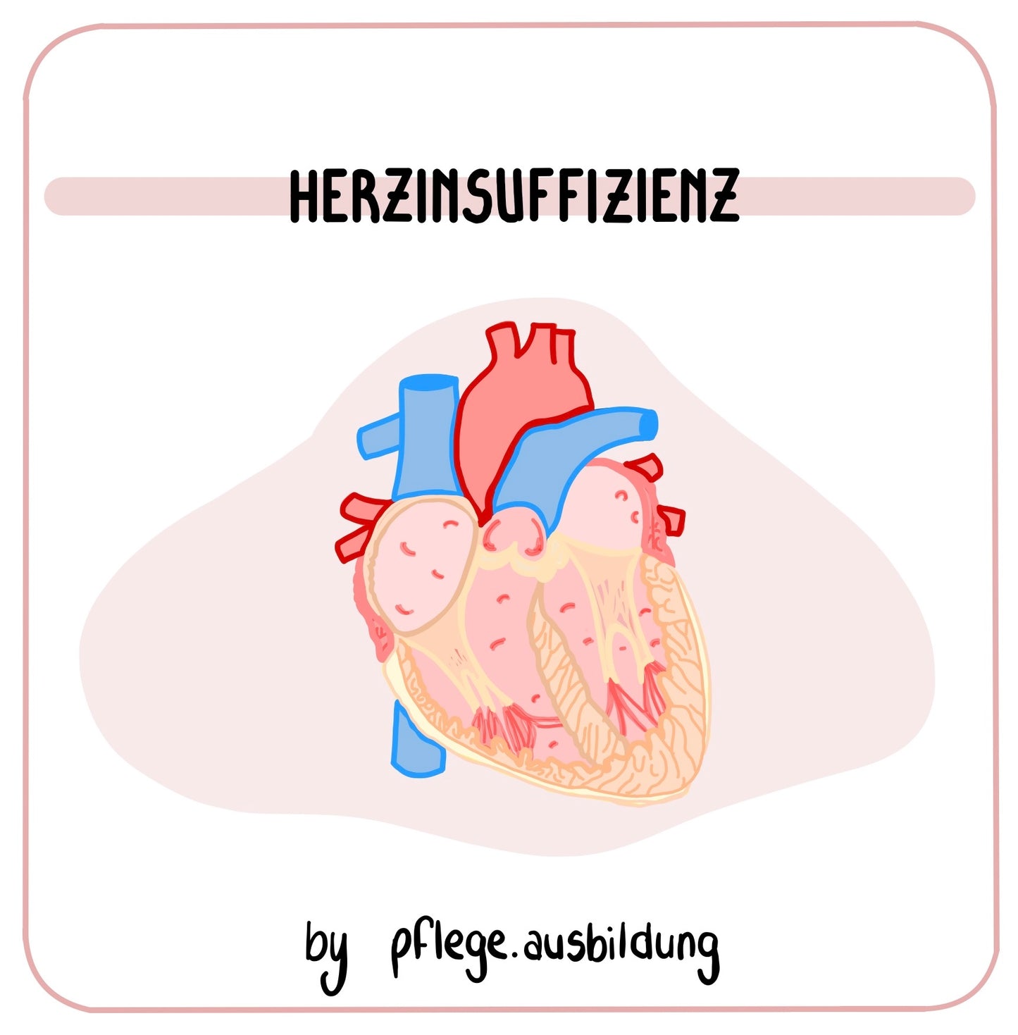 Herzinsuffizienz
