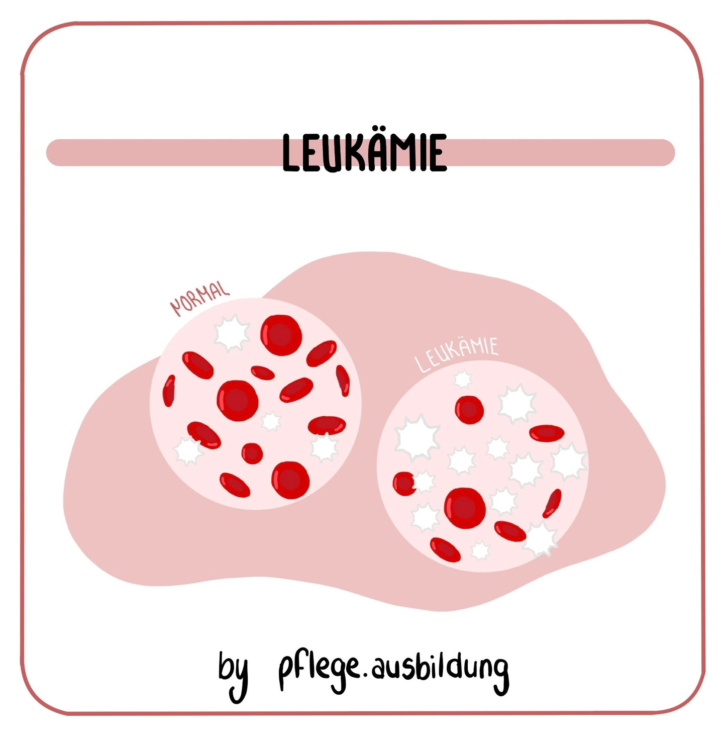 Leukämie