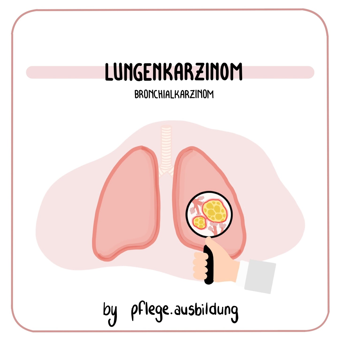 Lungenkarzinom