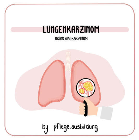 Lungenkarzinom