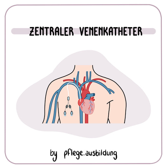 Zentraler Venenkatheter
