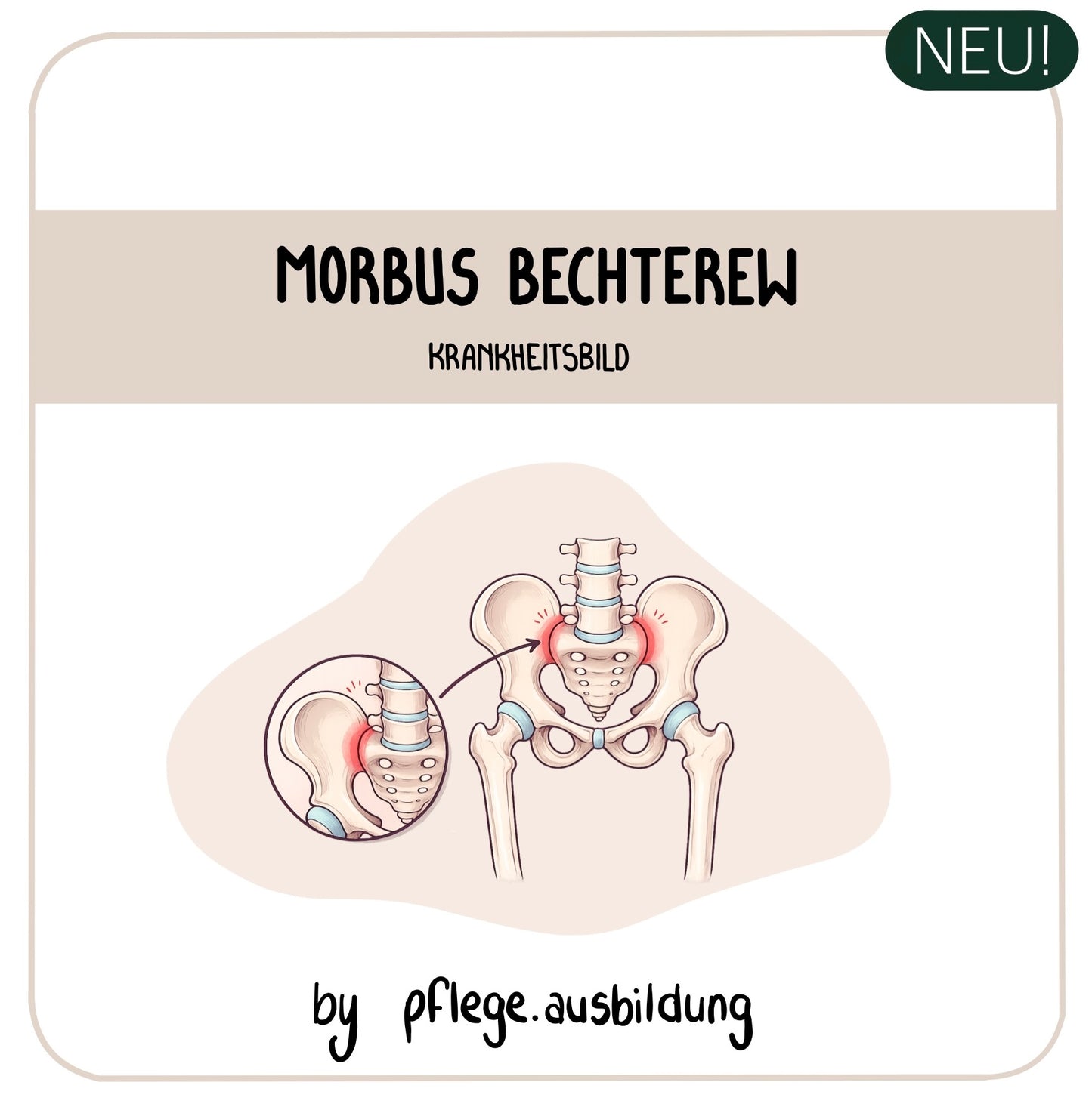 Morbus Bechterew