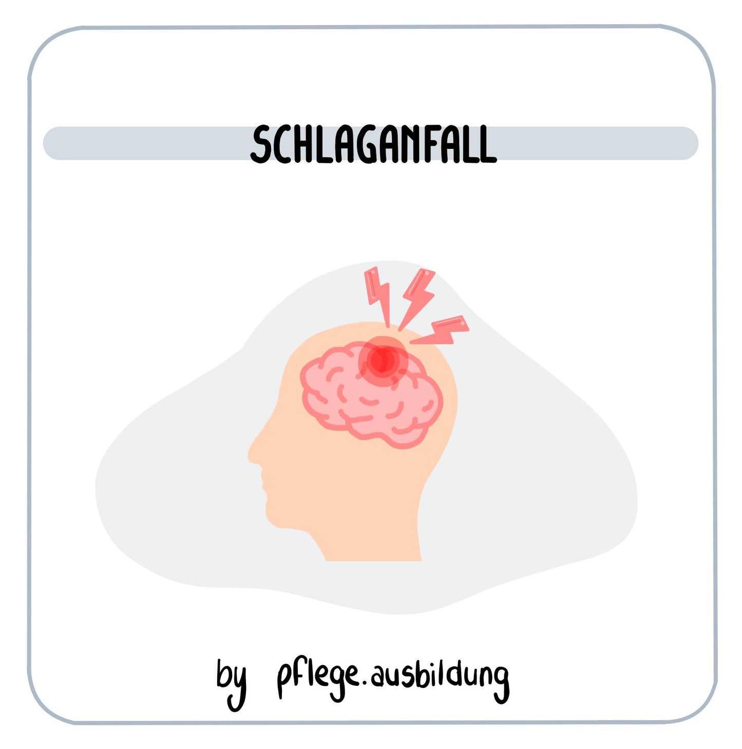 Schlaganfall